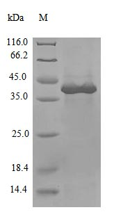 Severe acute respiratory syndrome coronavirus 2 Non-structural protein 3 protein