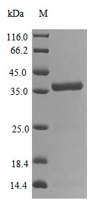 Severe acute respiratory syndrome coronavirus 2 3C-like proteinase protein