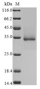 Novel Coronavirus Spike glycoprotein protein