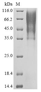 Human SARS coronavirus Spike glycoprotein protein