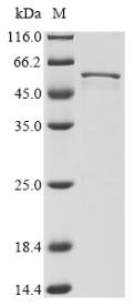 Human coronavirus NL63 Nucleo protein