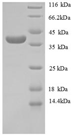 Human COL4A1 protein