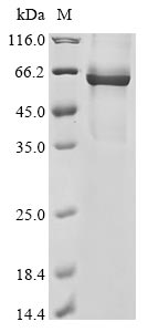 coronavirus OC43 Nucleo protein