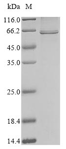 coronavirus HKU1 Nucleo protein