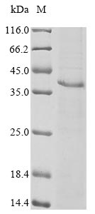 coronavirus HKU1 Hemagglutinin-esterase protein