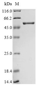 Human SARS coronavirus Nucleo protein