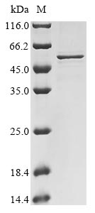 Human SARS coronavirus Nucleo protein