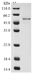 coronavirus OC43 Nucleo protein