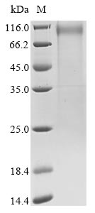 Human coronavirus 229E Spike glycoprotein protein