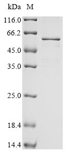 coronavirus HKU1 Nucleo protein