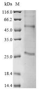 Human coronavirus NL63 Membrane protein