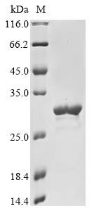 Human SARS coronavirus Protein non-structural 7b protein