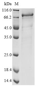 Human coronavirus NL63 Spike glycoprotein protein