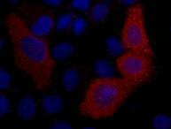 VSV G tag Mouse mAb Antibody