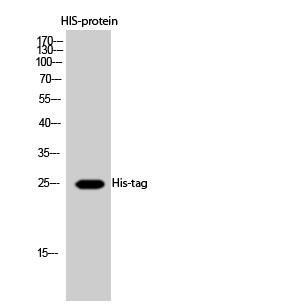 His Tag Rabbit pAb Antibody