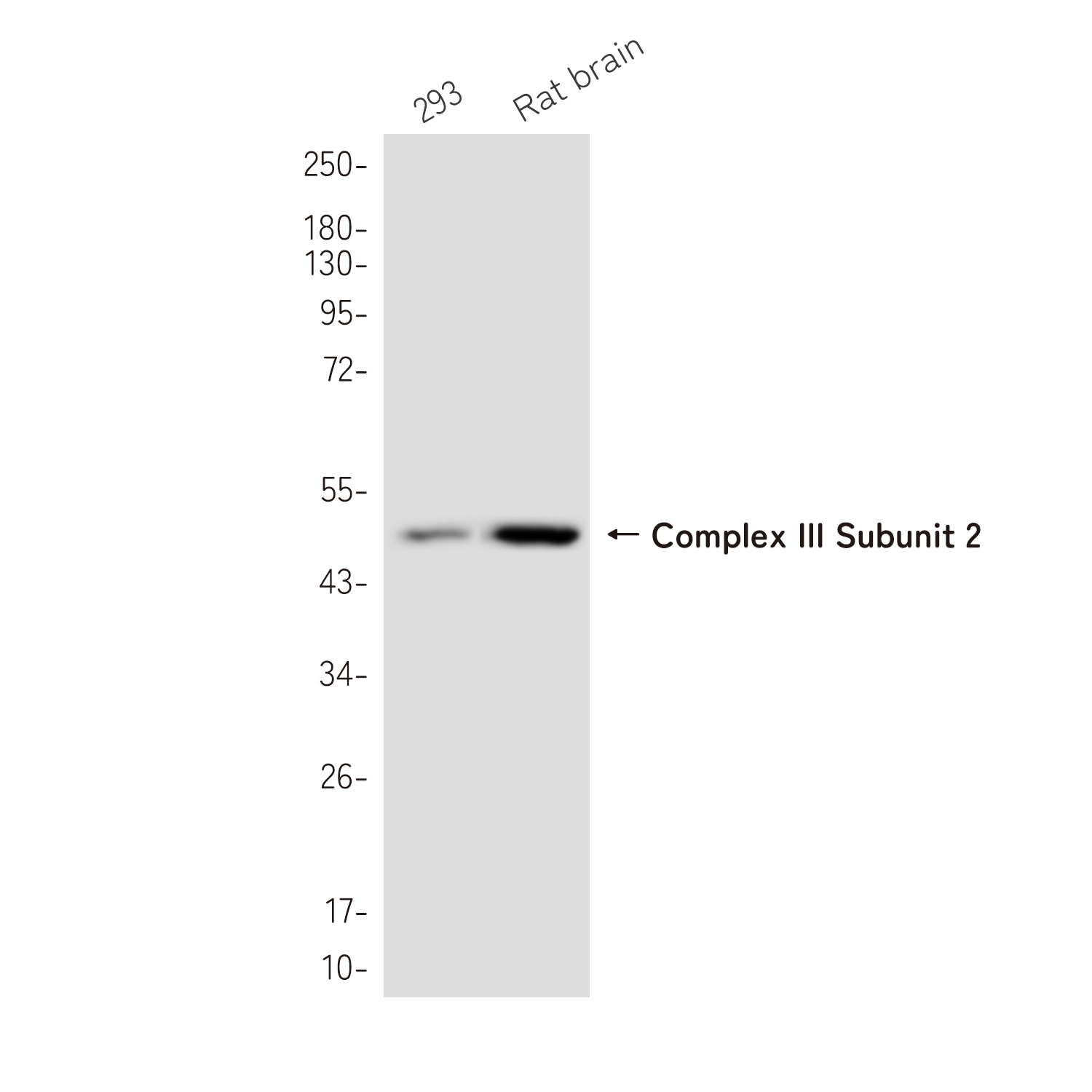 UQCRC2 Rabbit Monoclonal Antibody