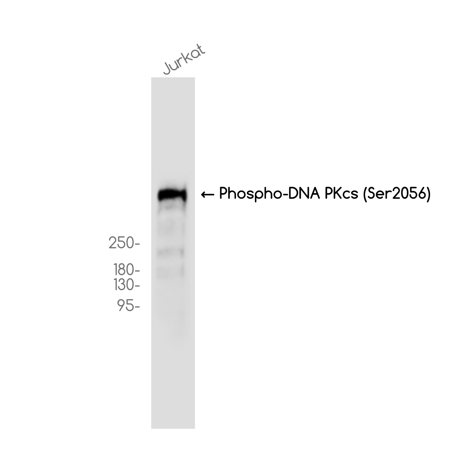 Phospho-DNA PKcs (Ser2056) Rabbit mAb