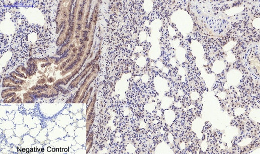Phospho-PERK (Thr982) Rabbit Polyclonal Antibody