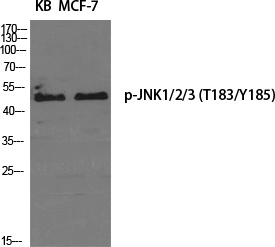 Phospho-JNK (Thr183/Tyr185) Rabbit pAb