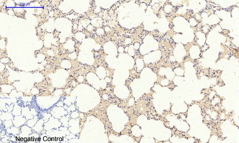 HIF1 alpha Rabbit pAb