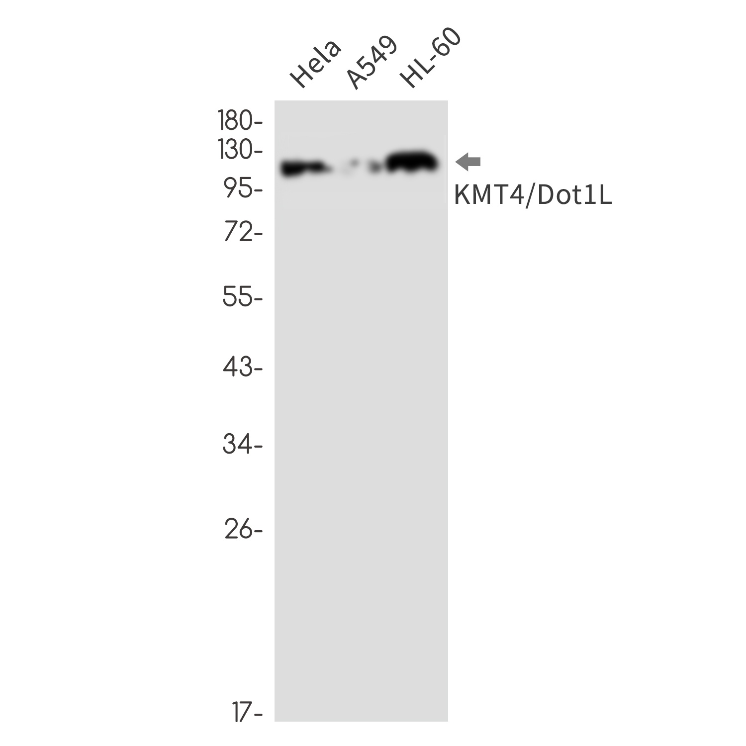 KMT4 Rabbit mAb