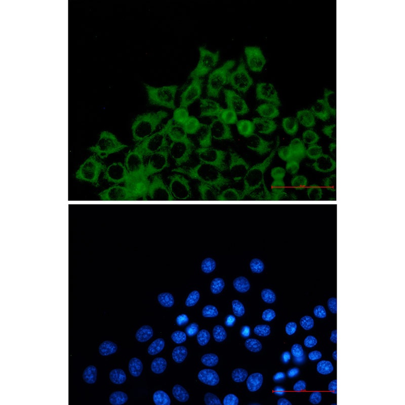 TOMM20 Rabbit Monoclonal Antibody
