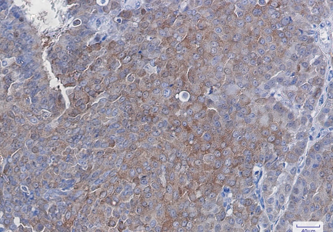 SQSTM1/p62 Rabbit Monoclonal Antibody