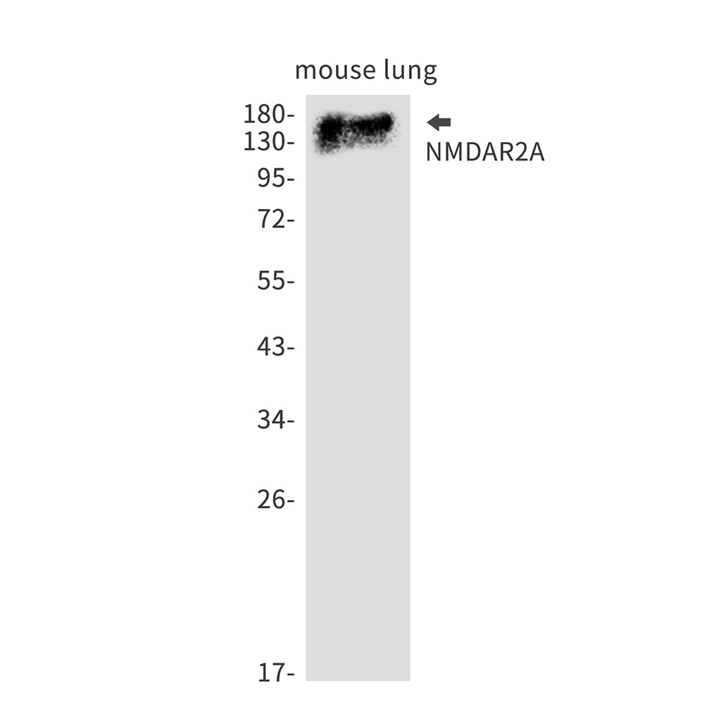 NMDAR2A Rabbit mAb