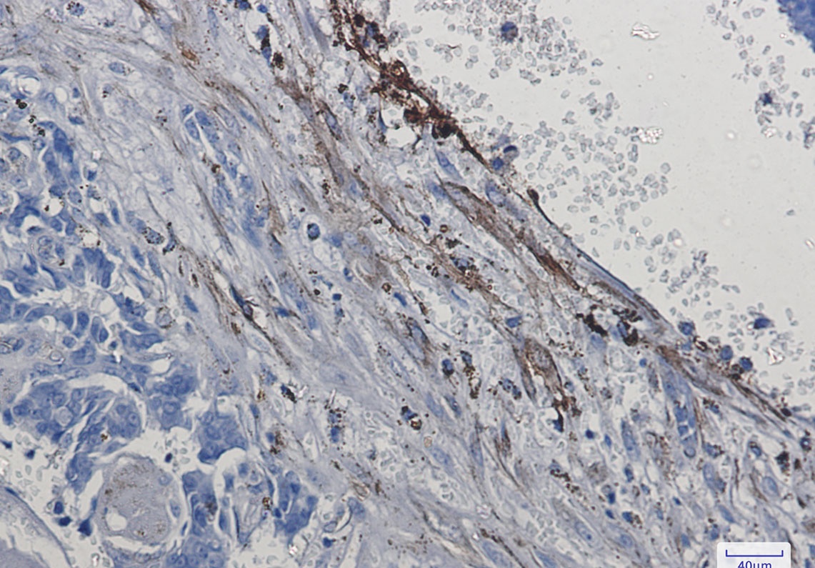 [KO] Integrin alpha 5 Rabbit mAb