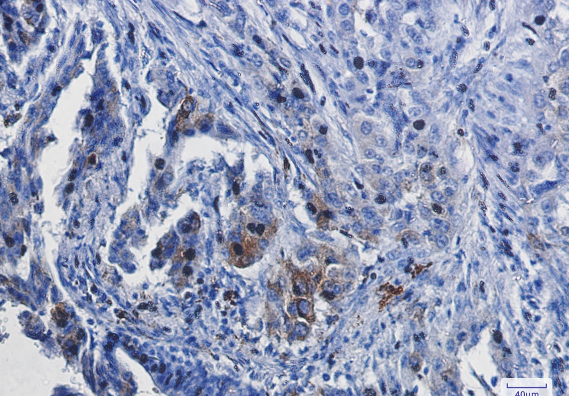 Heme Oxygenase 1 Rabbit Monoclonal Antibody