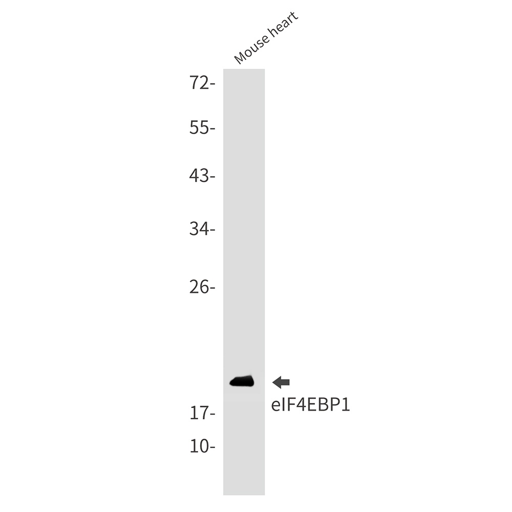[KO] 4E BP1 Rabbit mAb