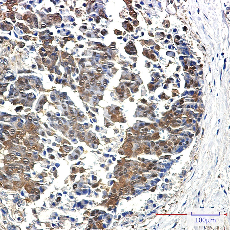 [KO] 4E BP1 Rabbit mAb
