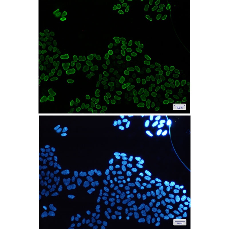 E2F1 Antibody
