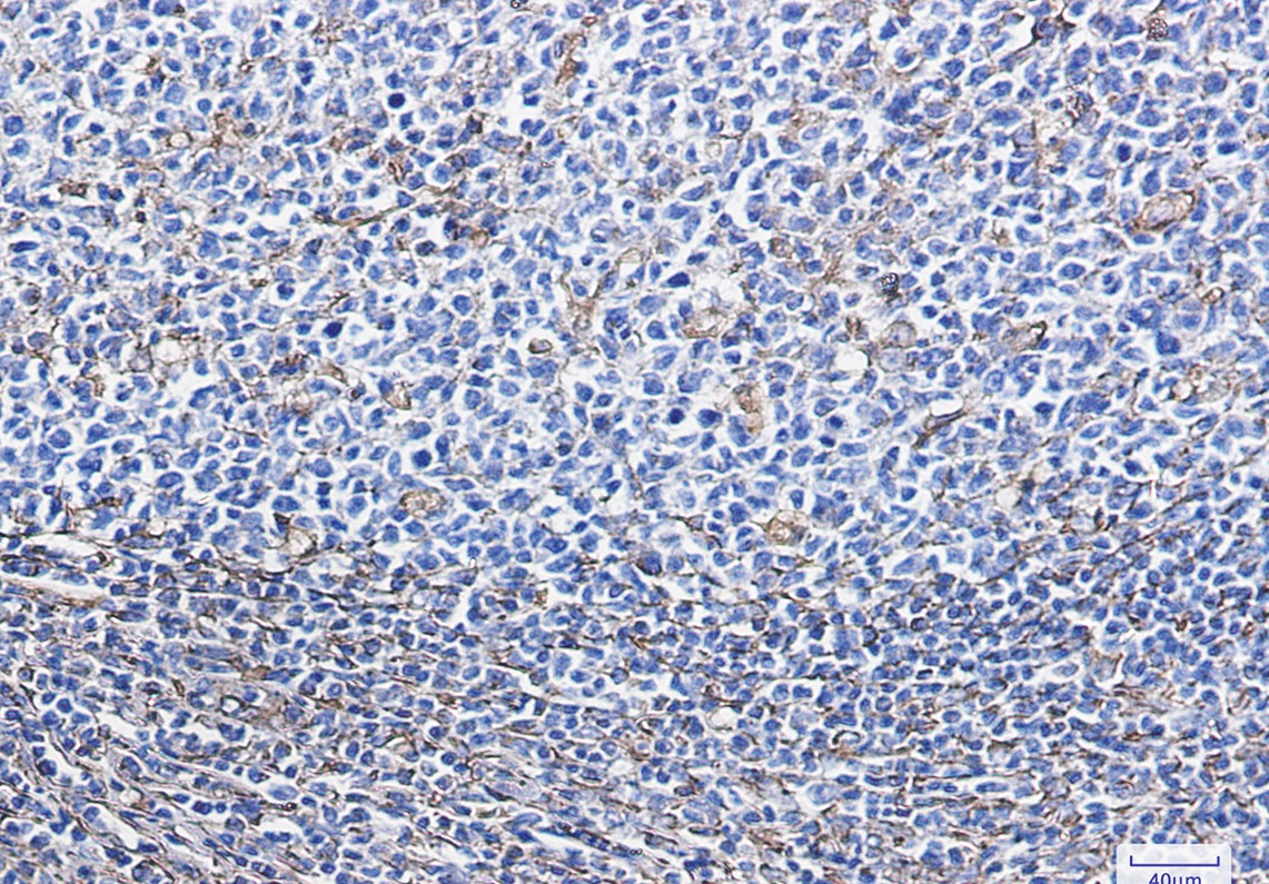 Vimentin Rabbit Monoclonal Antibody