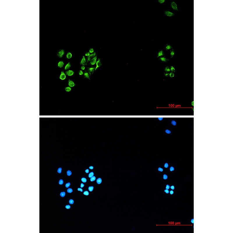 Vimentin Rabbit Monoclonal Antibody