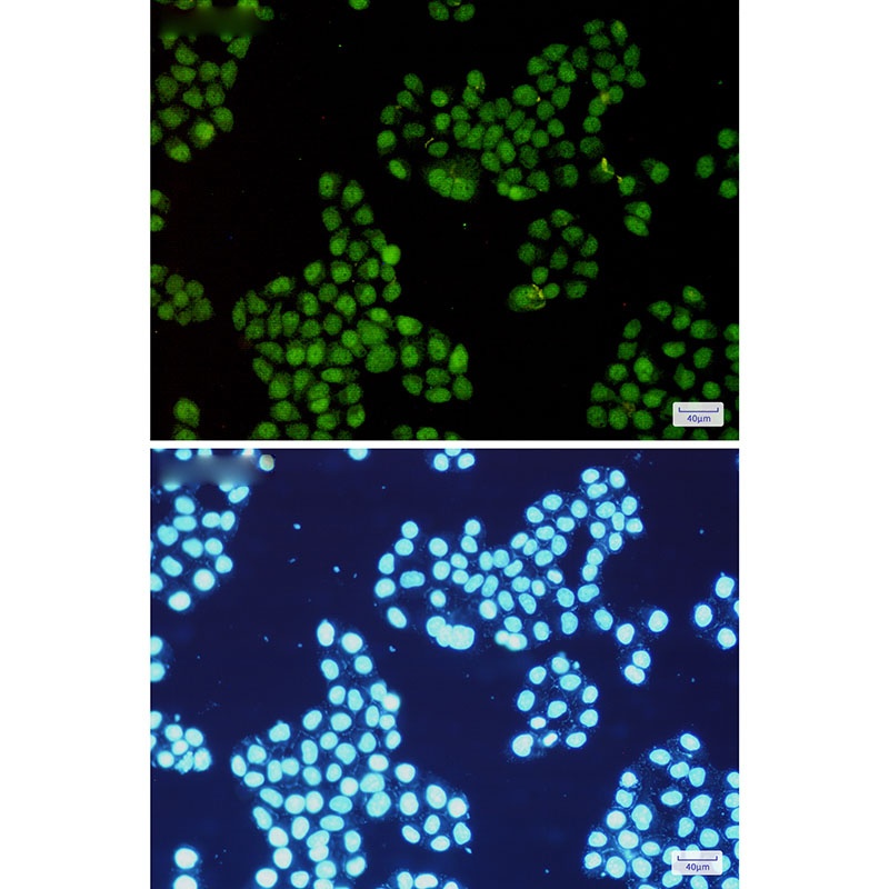 [KO] CDK2 Rabbit mAb