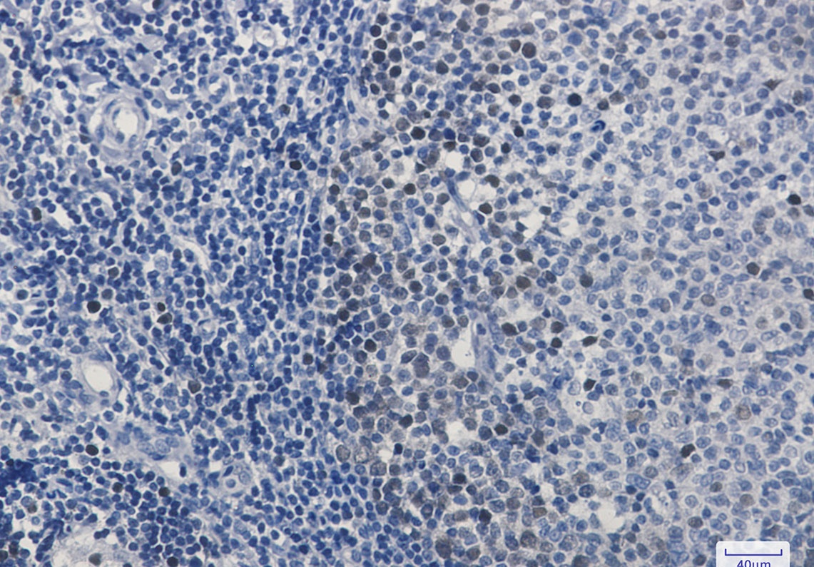 [KO] CDK2 Rabbit mAb