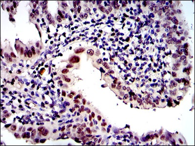 Proteasome beta 8 (3G3) Mouse mAb
