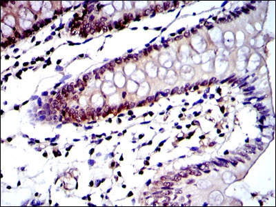 Proteasome beta 8 (3G3) Mouse mAb