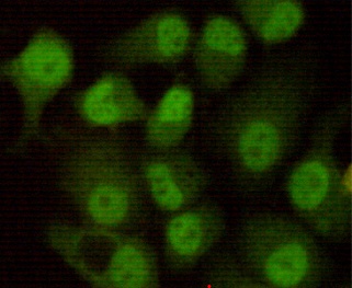 DNA PKcs Mouse Monoclonal Antibody