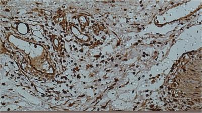 Galectin 3 (7G9) Mouse mAb