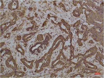 HSPA5 Antibody
