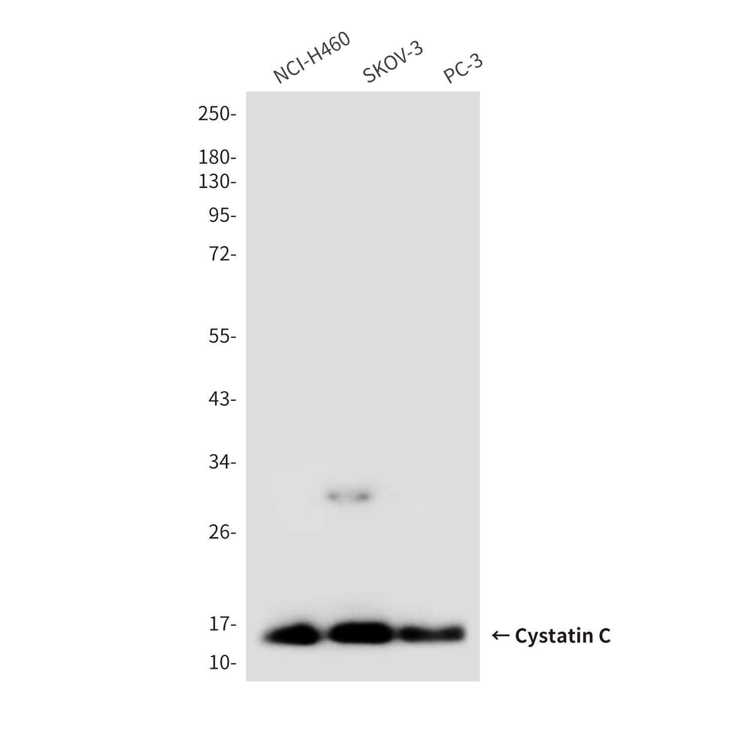 Cystatin C (6A4) Mouse mAb