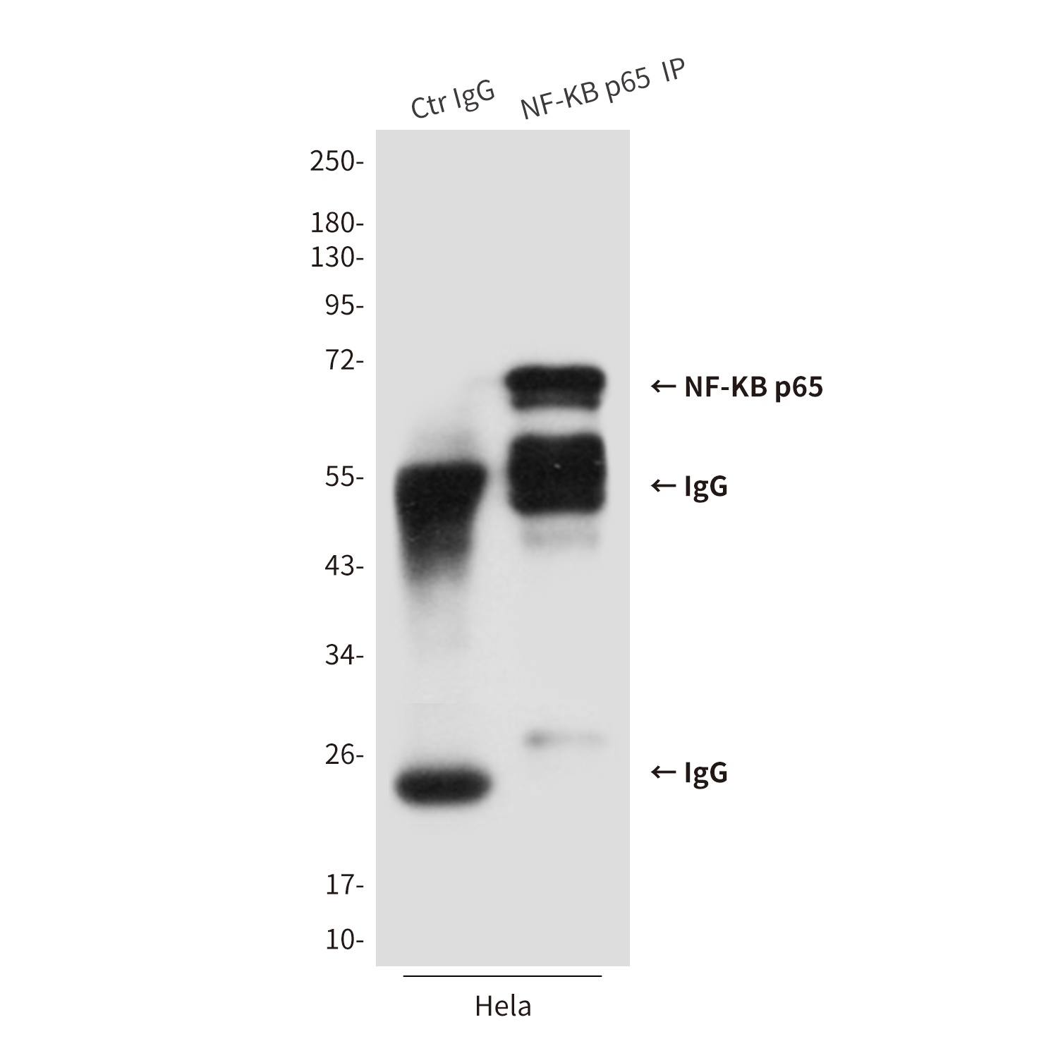 NF-KB p65 Mouse Monoclonal Antibody