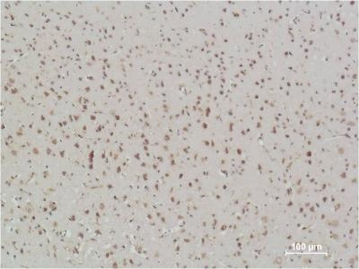 NF-KB p65 Mouse Monoclonal Antibody