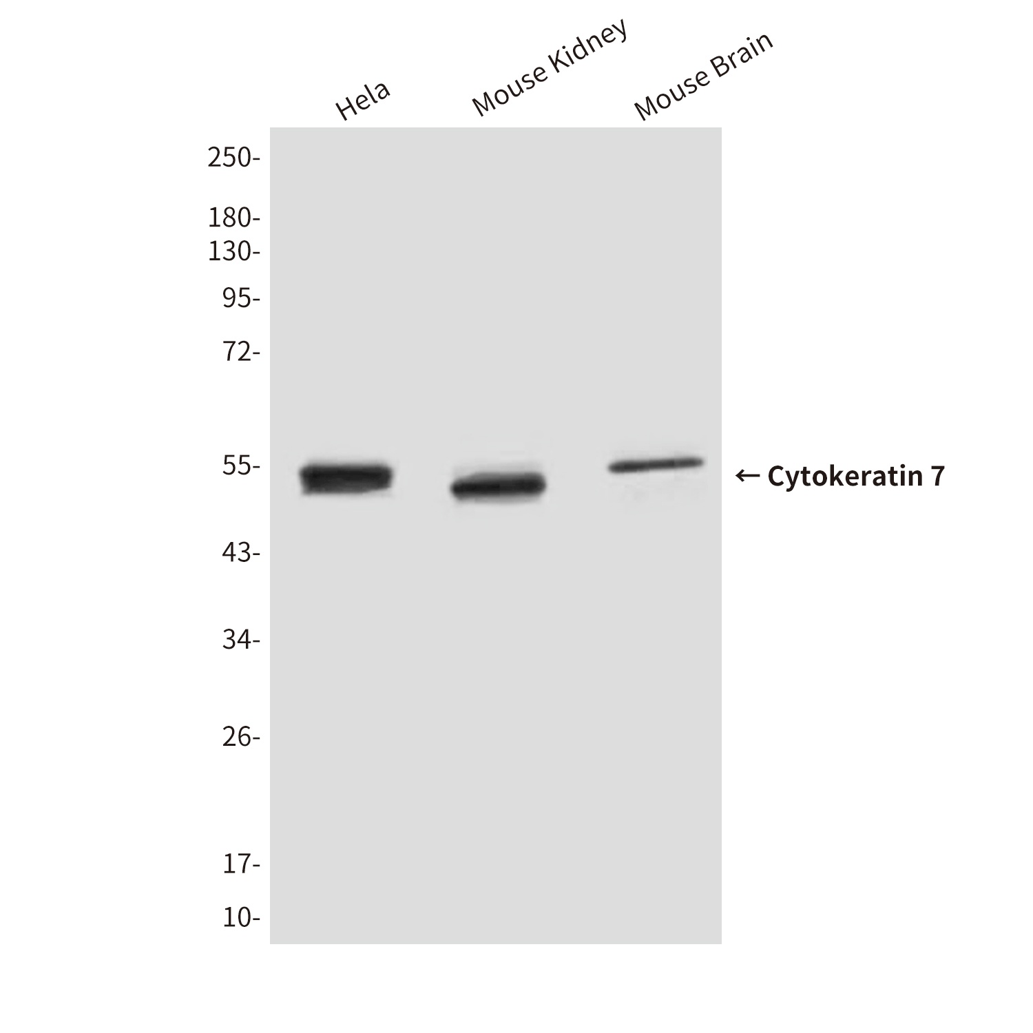 Cytokeratin 7 Mouse Monoclonal Antibody