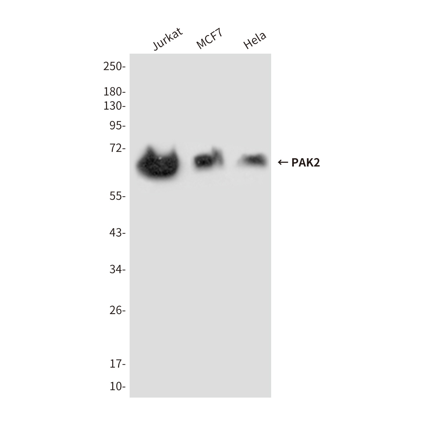 PAK2 Mouse Monoclonal Antibody