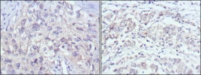 PAK2 Mouse Monoclonal Antibody