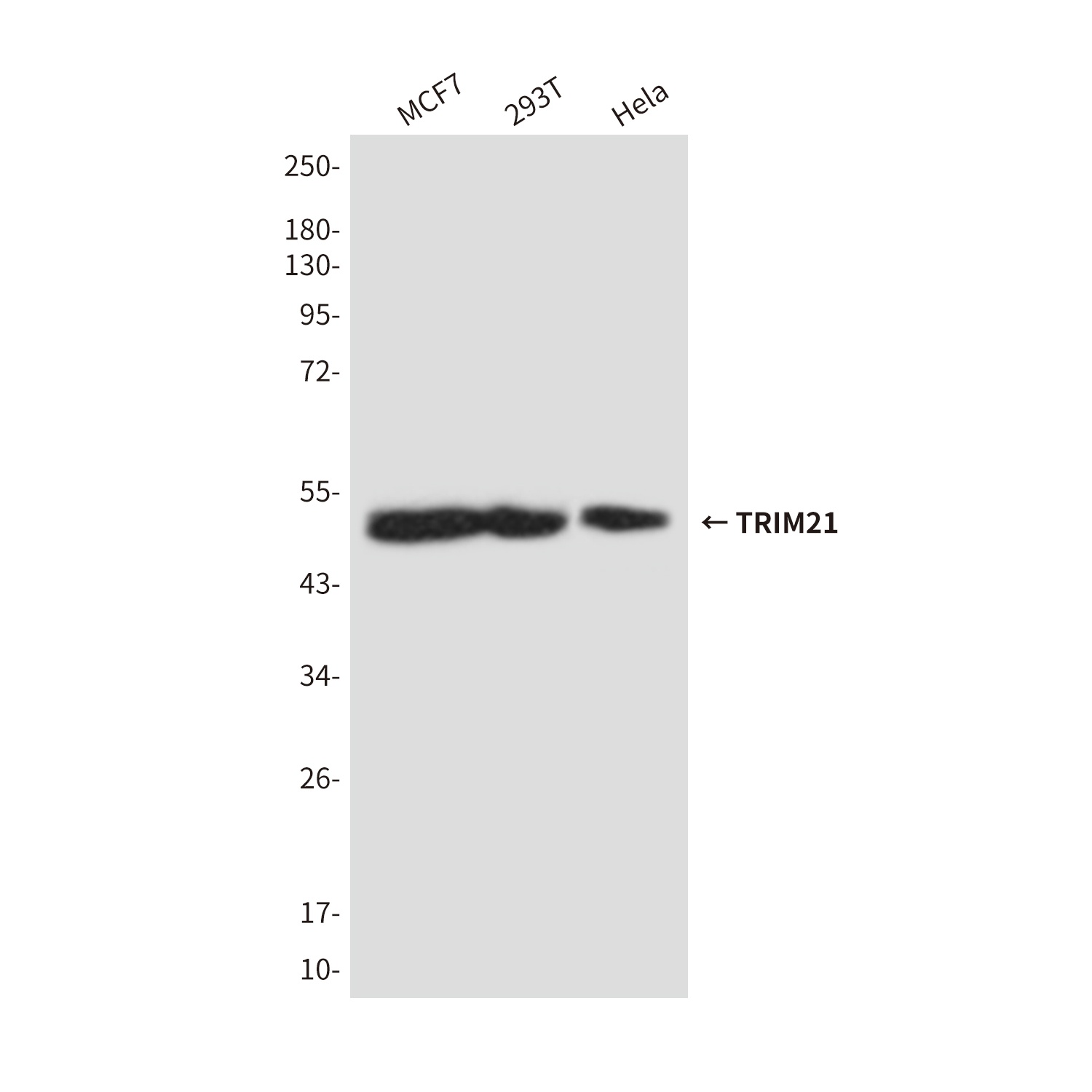 TRIM21 (5B9) Mouse mAb