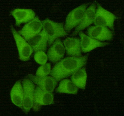 Fatty Acid Synthase Mouse Monoclonal Antibody